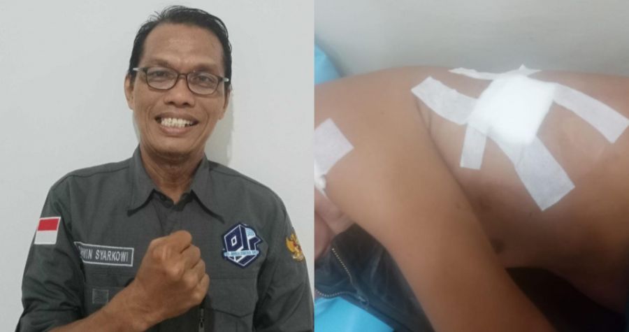 DPD Pro Jurnalismedia Siber Sumsel Meminta Polrestabes Palembang Turun Tangan Tangkap Pelaku Penusuk
